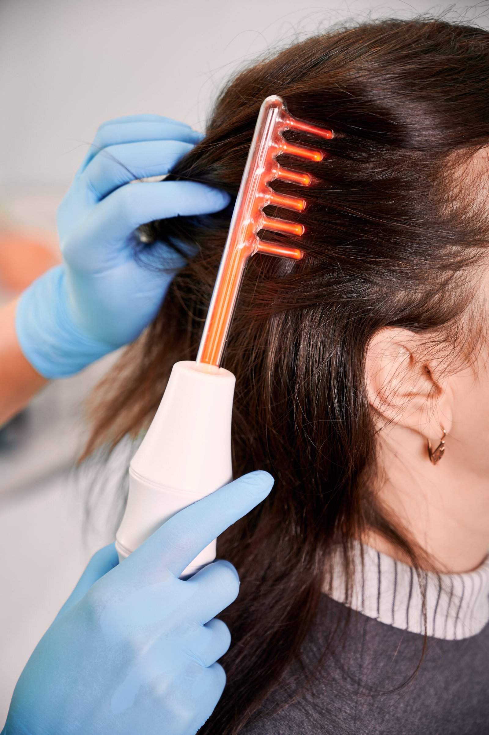 Hair Fillers Treatment